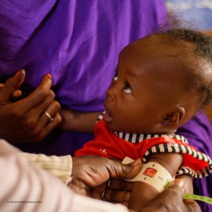 BM: “5 yaş altı çocuk ölümleri tarihin en düşük seviyesinde ancak ilerleme eşit değil”