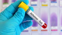 İngiltere’de yeni kan testleriyle Alzheimer ve demans erken teşhis edilebilir mi?